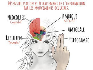 EMDR